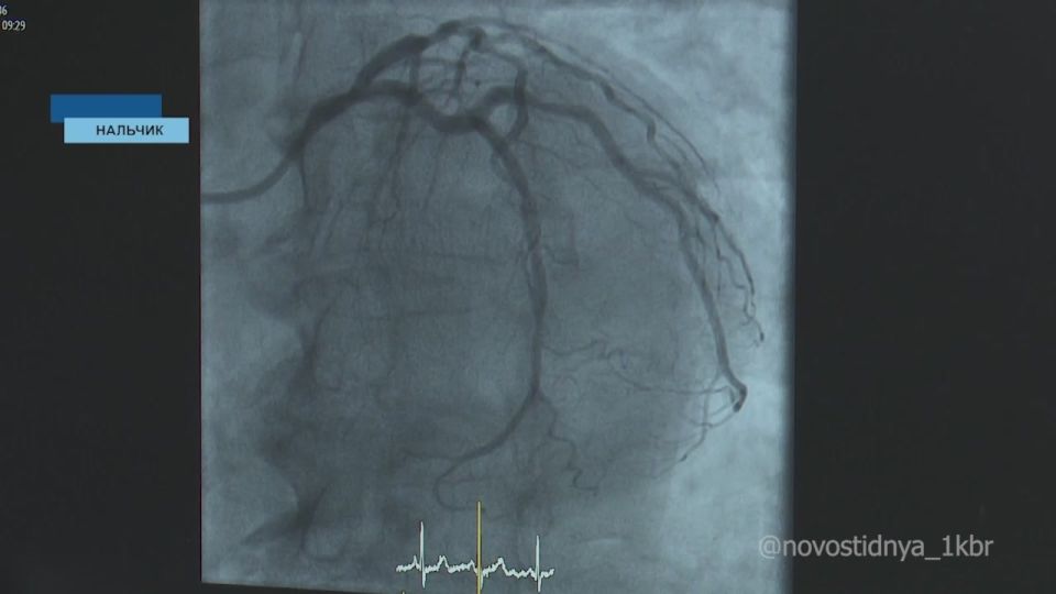 ��������� �����������, �� ���� ��� ���������� � ����� ��������