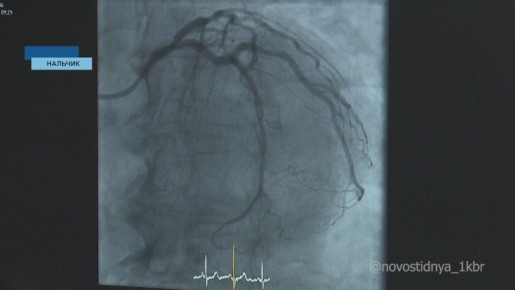 Праздники праздниками, но надо еще задуматься о своем здоровье