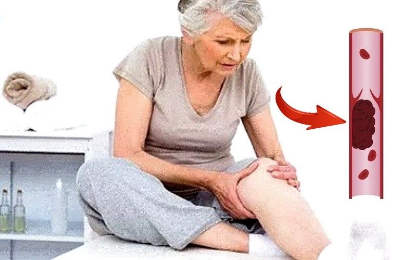 ������ ����� 60: ������ ������ �� ������ � �������